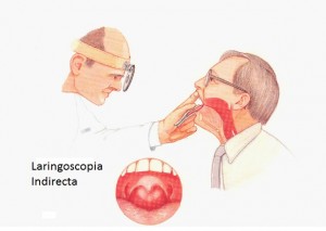 laringoscopia